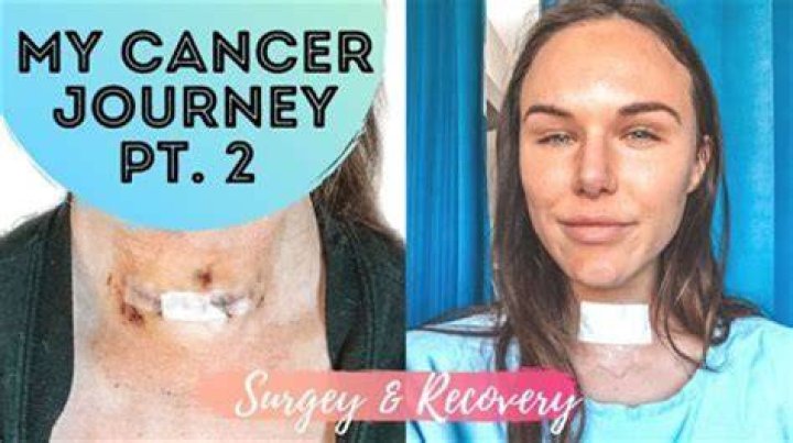 Joyce Vance Tackles Thyroid Journey: Inspiring Insights And Support