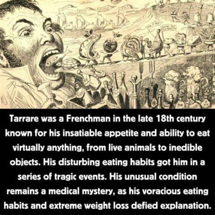 Tarrare's Extraordinary Medical Condition: An Enigma Of Extreme Hunger And Curious Consumptions